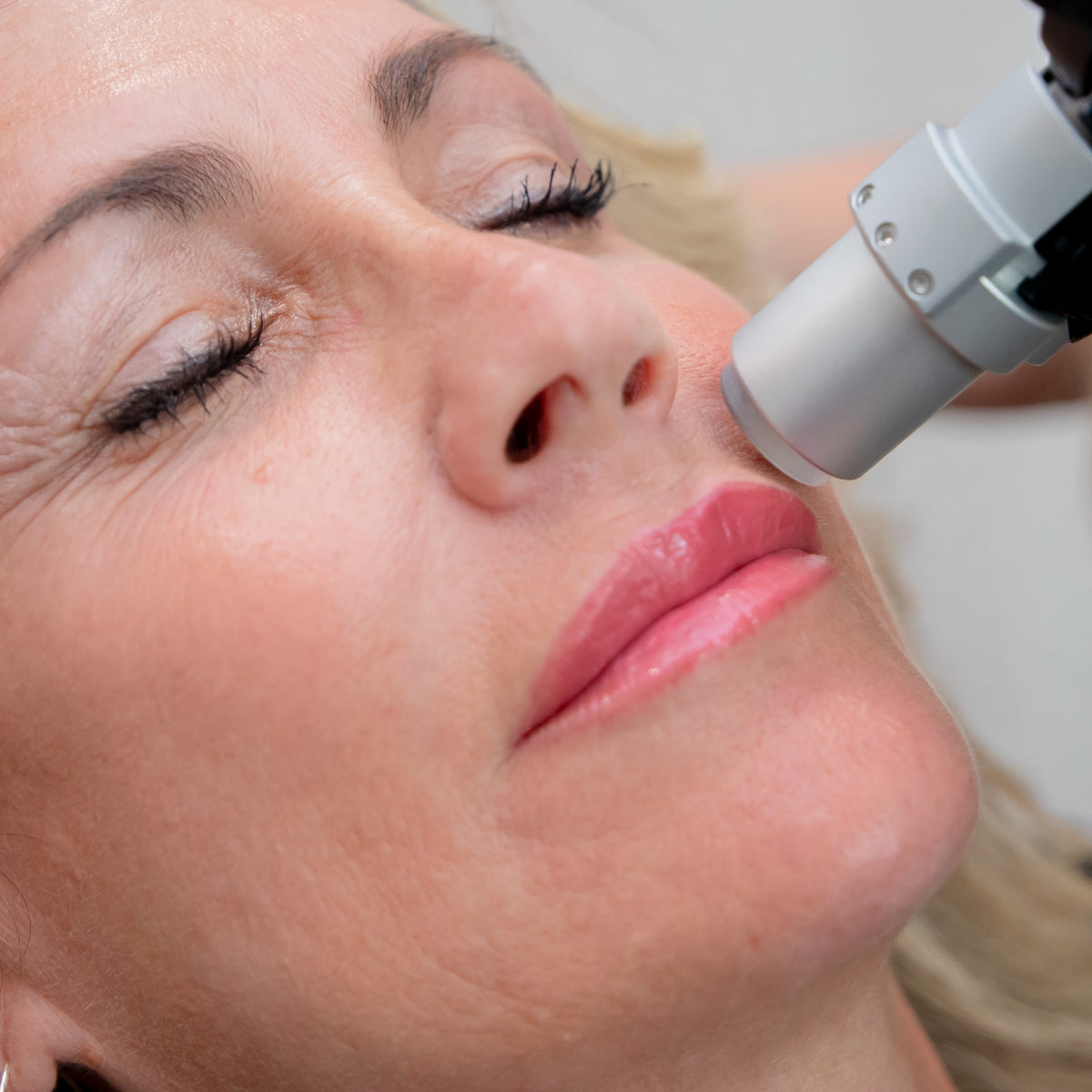 Painless Laser Hair Removal Middletown & Lewes Service Mint & Needle