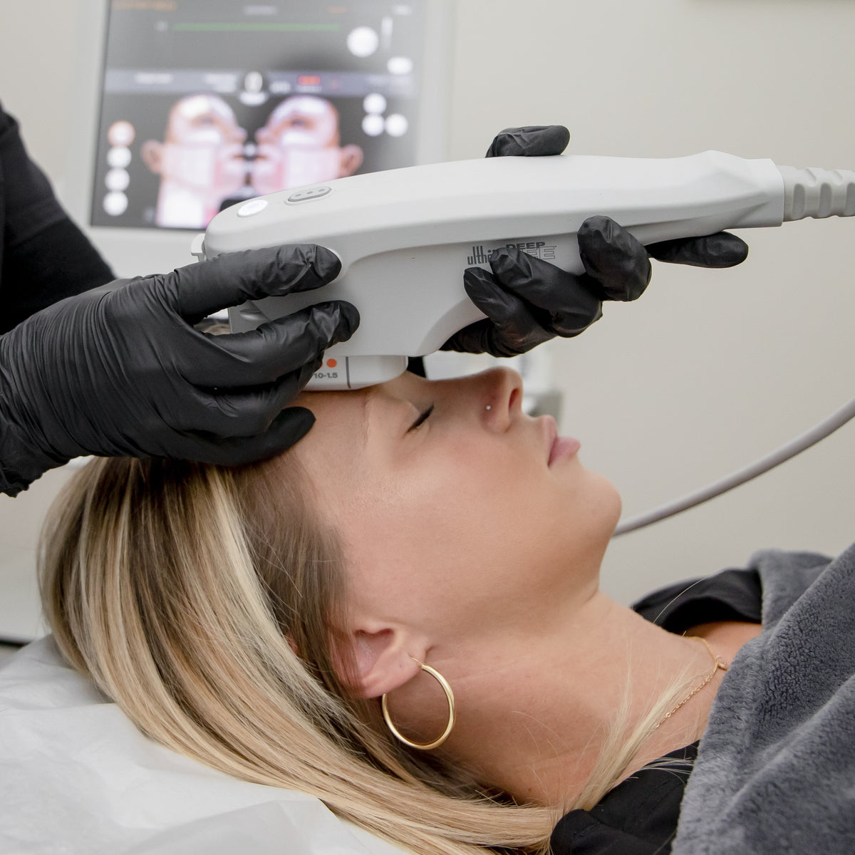 Browlift with Ultherapy Mint and Needle Mint & Needle