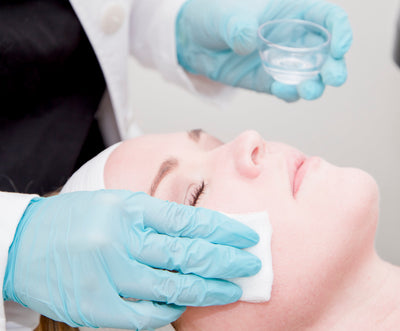 Benefits of a Chemical Peel