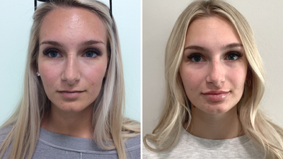 Our Most Dramatic Medical Aesthetic Before and Afters