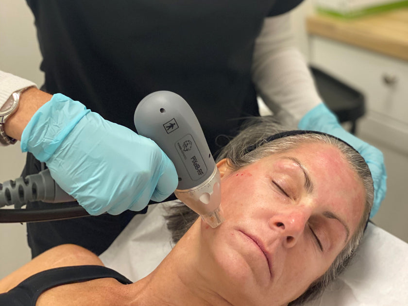 Collagen Induction Therapy Why You Should Start ASAP Mint & Needle