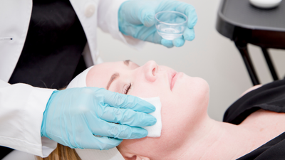 The Top FAQs About Chemical Peels